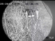 تصویربرداری حرارتی دوربین 15 مگاپیکسلی IR Laser با لنز زوم